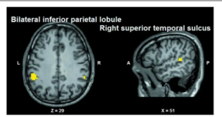 FIGURE 6 | Group statistical maps (conjunction thresholded at p &lt; 0.05 corrected; k &gt; 10) showing overlapping modulation by the observation of different tactile sensations as well as by different facial expressions