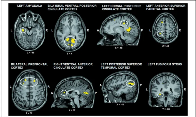 FIGURE 2 | Voxel clusters (thresholded at p &lt; 0.05 corrected; k &gt; 10) characterized by a significant interaction effect “facial expression × tactile sensation.” BOLD responses in these clusters were stronger during the congruent conditions, compared 