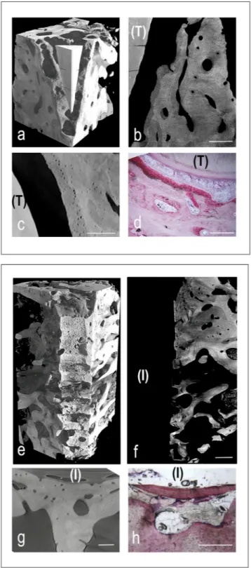 Figure 2.  Cross-linking of microCT and histological images in peri-implant (panels a-d) and peri-dental  (panels e-h) representative sites of the retrieved samples