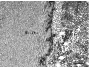 Figure 10. Transmission electron micrograph: high magniﬁcation of the Bio-Oss 姞 bone interface
