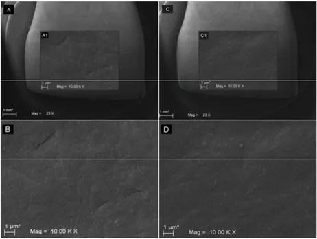 Figure 1. SEM images showing the human enamel surface alterations before and after the glycine 