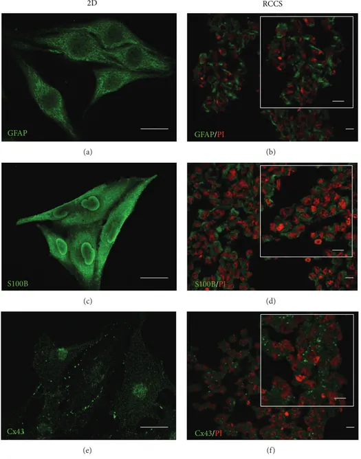 Figure 3: Glial marker localisation in GL15 cells. Representative confocal images of GL15 cells cultured as a monolayer (2D, (a), (c), and (e)) and under the modelled microgravity (RCCS bioreactor, (b), (d), and (f)) and immunostained with anti-GFAP ((a) a