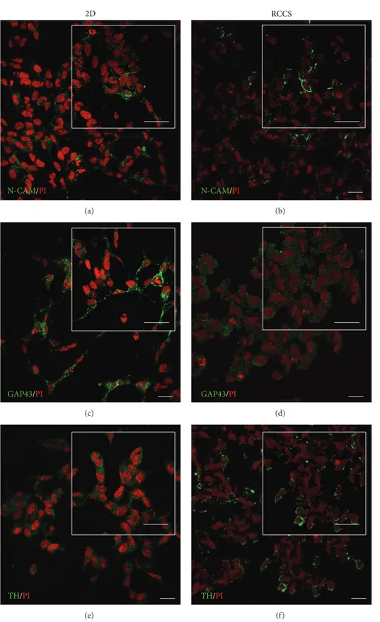 Figure 4: Neuronal marker localisation in SH-SY5Y cells. Representative confocal images of SH-SY5Y cells cultured as a monolayer (2D, (a), (c), and (e)) and under the modelled microgravity (RCCS bioreactor, (b), (d), and (f)) and immunostained with anti-N-
