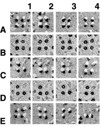 Figure 5. Montage of tetrads either unidirectionally (A, C, and E) or rotary (B and D) shadowed