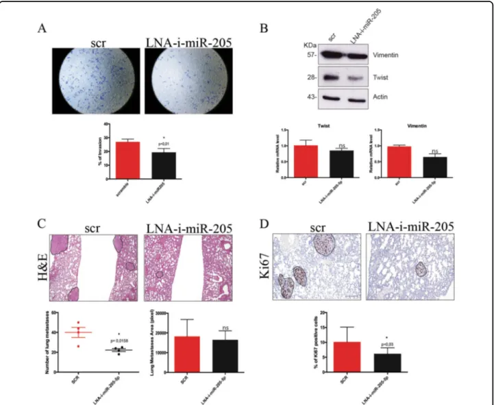 Fig. 6 miR-205-5p LNA inhibitor reduces BCSCs metastasis in vitro and in vivo regulating EMT