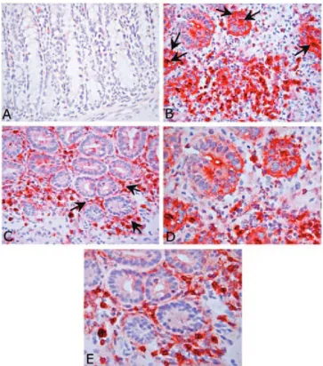 Fig. 5. Immunohistochemical analysis of colon section from WT and CXCR2 ⫺/⫺ mice. Immunohistochemistry on intestinal sections from mice exposed to normal water or two cycles of DSS and killed at day 27