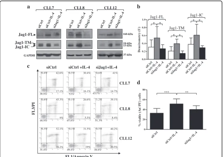 Fig. 8 Jag1 silencing counteracts the IL4-dependent increase of CLL cell viability. a –d CLL cells were transfected with control siRNA (siCtrl) and Jag1 siRNA (siJag1), as described in “Materials and methods”, and then were cultured for 72 h in complete me