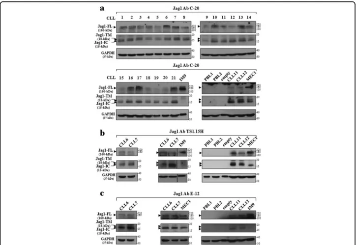 Fig. 1 Jag1 is constitutively processed in CLL cells. a –c Western blot analysis of Jag1 was performed in 25 µg whole-cell lysates (WCL) from primary CLL cells (n = 21), MEC1 cell line, and PBL from healthy donors (n = 3), using three different C-terminal 