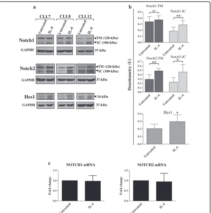 Fig. 6 IL-4 enhances Notch1 and Notch2 expression and activation in CLL cells. a –c CLL cells were cultured for 24 h with or without 25 ng/ml IL-4 (n = 6; CLL7-12, selected to include patients with different clinical and biological characteristics)