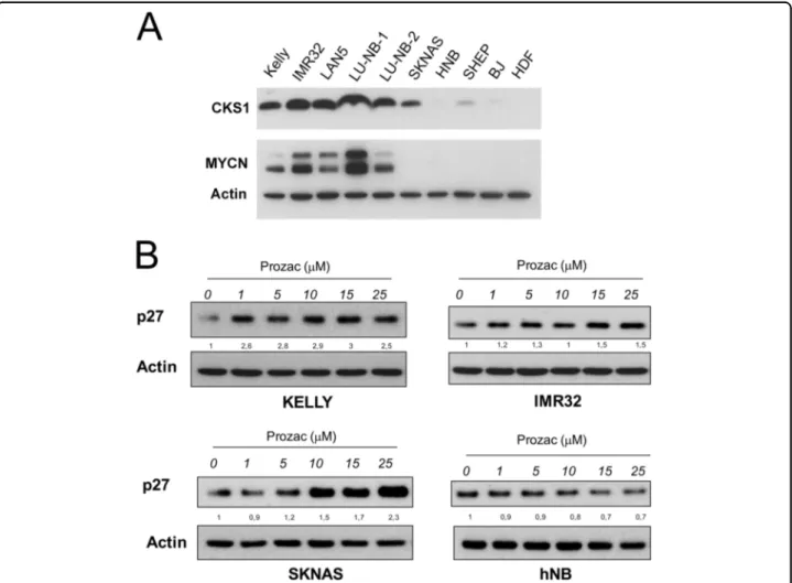 Fig. 1 CKS1 and p27 expression in neuroblastoma cell lines. a Protein extracts from neuroblastoma cell lines (MYCN ampli ﬁed = Kelly, IMR32, LAN5, LU-NB-1, LU-NB-2; non-MYCN ampli ﬁed = SKNAS, SHEP, hNB), normal human dermal ﬁbroblasts (hDF) or immortalise
