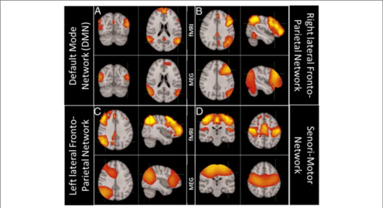 FIGURE 5 | Comparison of brain networks obtained using ICA independently on MEG and fMRI data