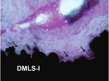Fig. 10   The direct metal laser sintered surface (DMLS-I) is extremely  irregular but enables bone growth around and within its indentations  (arrows)