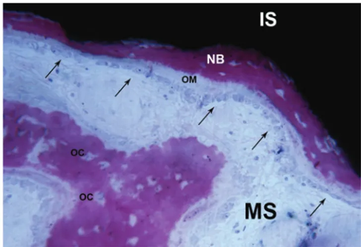 Fig. 13   Many osteocytes (arrows) are present at the level of the peri-  implant bone, very close to the implant surface (IS)