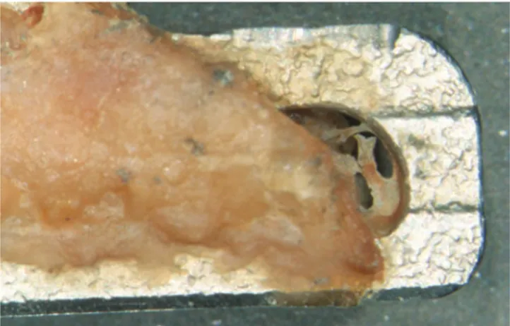 Fig. 22   A retrieved blade partially surrounded by hard tissues G. Iezzi et al.