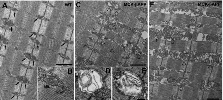 FIGURE 1. EDL muscle fibers from MCK-␤APP mice showed severe mitochondrial alterations