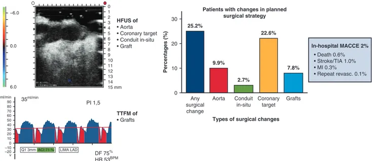 FIGURE 2. Changes to the planned surgical strategy were made in 25.2% of cases with few complications