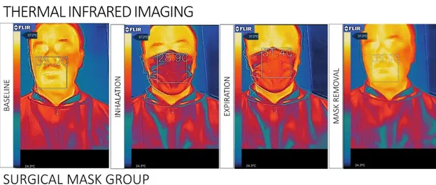 Figure 2. Surgical mask group: The infrared images of facial skin temperature distributions associated 
