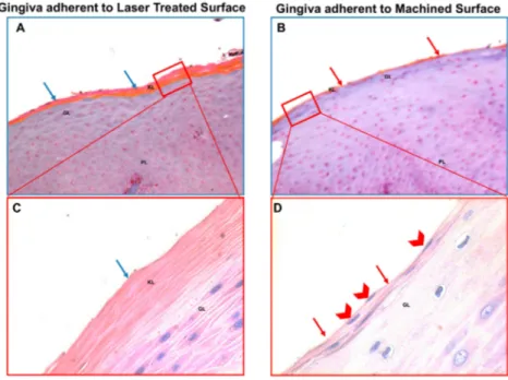 Figure 4. Trichrome staining (A,B) and May–Grünwald–Giemsa (C,D) staining of the region of the gingiva adherent to the laser treated (A,C) or to machined (B,D) surfaces, as indicated