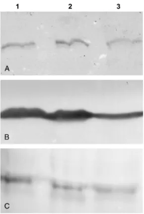 FIGURE 3. Immunoblots of ryanodine receptor (RyR) (A), calsequestrin (B), and sarco(endo)plasmic reticulum Ca( 2+  )-ATPase (SERCA) (C) using 200 Kg protein aliquots of total homogenate of normal adult rat muscle [1], and 13 weeks [2] and 44 weeks [3] post