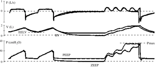 Fig. 1.—Maneuvers for P-V curves acquisition using the low sinusoidal flow technique. Schema illustrating the record- record-ing maneuvers for the acquisition of the pressure-volume curves at ZEEP and at PEEP with the low sinusoidal flow  tech-nique