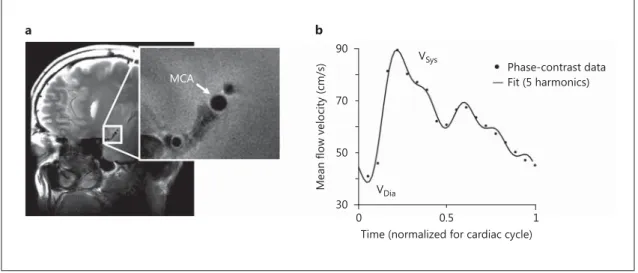 Fig. 1.     a   Example of T  2  -weighted high-resolution structural image of the cross-sectional area of the M1 segment 