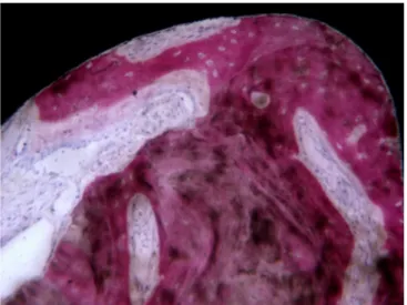 Figure 6. Many remodeling areas were detected. Ongoing apposition and resorption phenomena were present inside the threads