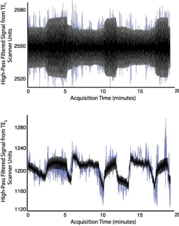 Fig. 6. Example voxel-wiseﬁt of in vivo data. Top: Processed TE 1 data (blue) andﬁt (black)