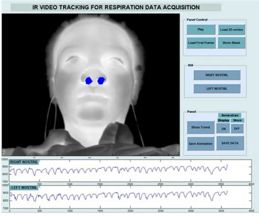 Figure 3. Thermal signal extracted from right and left nostrils regions [48]. 