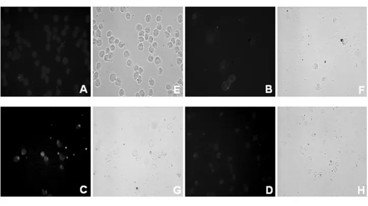 Figure 3. (a) TUNEL detection of apoptosis and phase contrast light microscopy (E–H) of Jurkat T cells exposed to 6-Gy ionizing radiation (A-D)