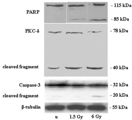 Figure 4. Effect of 1.5- and 6-Gy ionizing radiation on PARP, PKC␦, and caspase-3 expression and