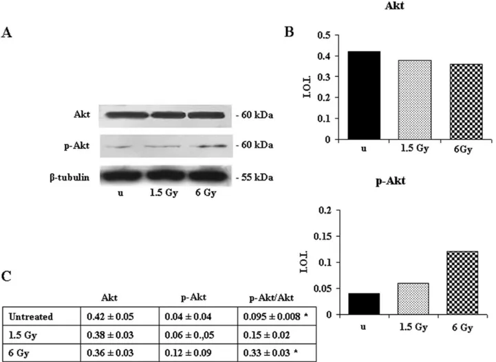 Figure 6. Effect of 1.5- and 6-Gy ionizing radiation on Akt and p-Akt (Ser 473) expression in Jurkat T cells