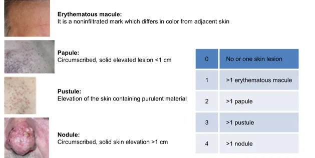 Figure 1 skin lesion score according to the eruption score system.