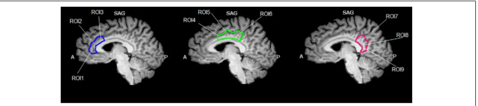 FIGURE 1 | Region of interest (ROIs) used. Image shows the ROIs used for the FC analysis and their spatial location in the cingulate cortex