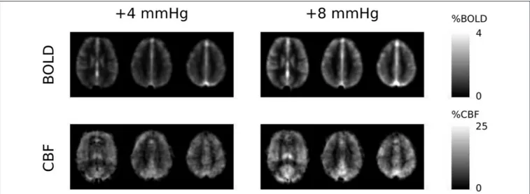 FIGURE 1 | Group-average maps of BOLD and CBF responses to the +4 and +8 mmHg 1P ET CO 2 hypercapnia conditions