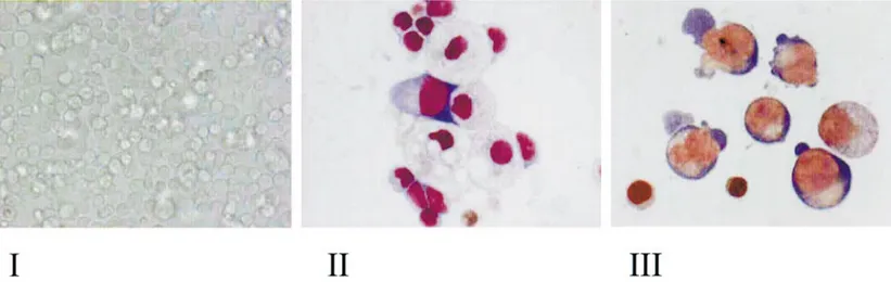 FIG. 6. Photograph of the cells in a representative proliferative cell culture (I) and May–Grunwald staining of cytocentrifuged preparations of cells obtained at day 7 (II) and day 16 (III) from the same culture (magnification: 10 ⫻ in I and 100 ⫻ in II an