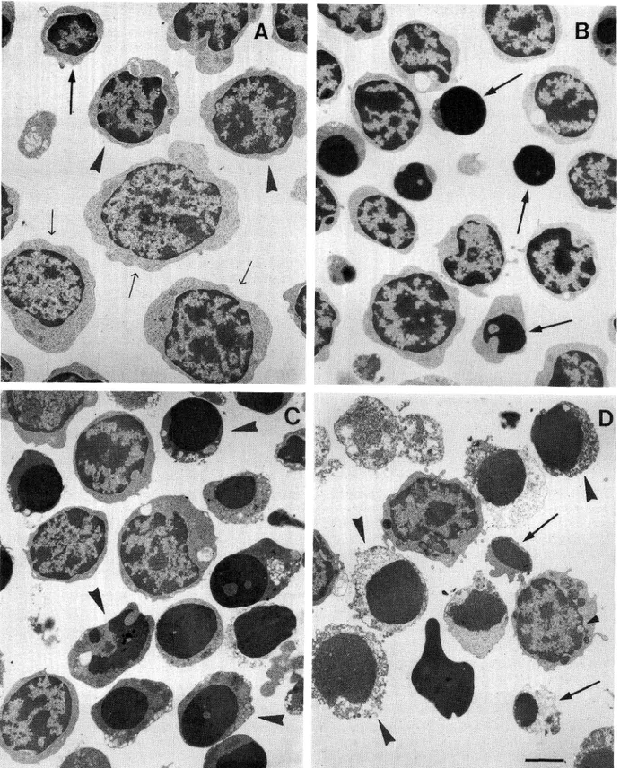 Fig. 2. Morphological analysis of Dx-treated thymocytes. A: Untreated thymocyte sub-populations