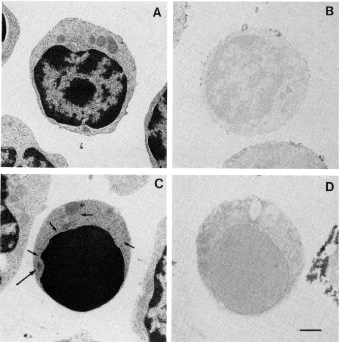 Fig. 3. Transmission electron microscope analysis of glutaraldehyde-osmium tetroxide fixed untreated (A) and treated (C) small-size thymo- thymo-cytes