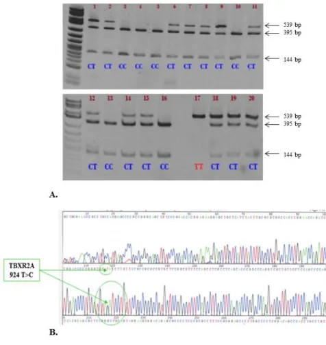 Fig. 1. A. Restriction enzyme analysis on agarose gel. B. The human TBXA2R gene is located on 