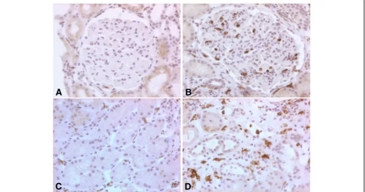 Fig. 1 Glomerular and interstitial macrophages in IgAN and MCD biopsies. Immunohistochemical staining