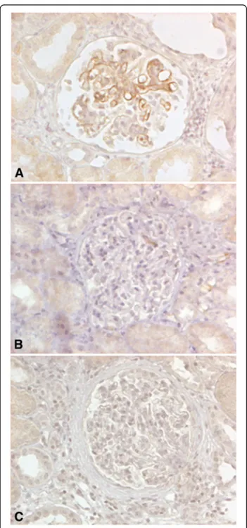 Fig. 3 C4d immune-reactivity in IgAN, MCD and lupus