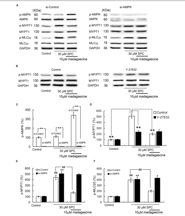 FIGURE 9 | Effects of small interfering RNA (siRNA) knockdown of AMPK and ROCK inhibitor Y27632 (10 µM) on madagascine induced the phosphorylation of MYPT1 (p-MYPT1) and the phosphorylation of MLC20 (p-MLC 20 ) in human coronary artery smooth muscle cells