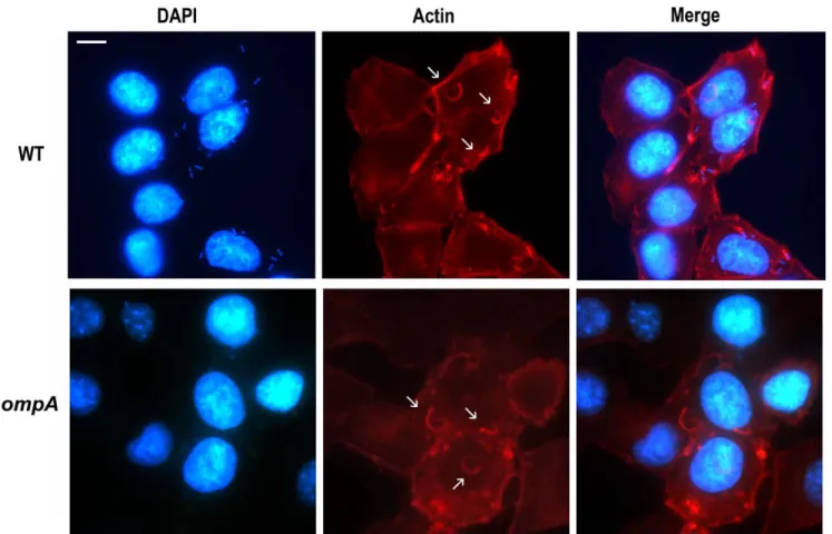 Figure 4. The ompA mutant retained the ability to form wild-type F-actin comet tails. Semi-confluent HeLa cell monolayers were infected with the wild-type strain (WT), the ompA mutant (ompA), and the ompA mutant complemented with plasmid pOA (ompA/pOA)