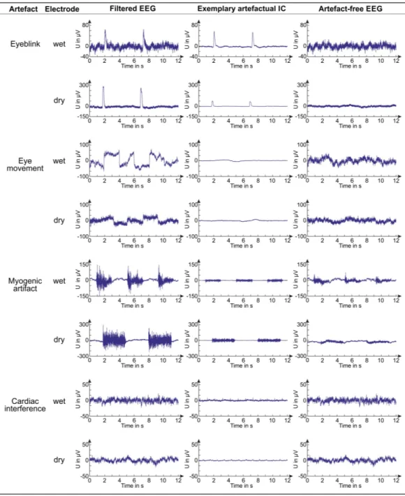 Figure 6 Examples of EEG signals before and after artifact removal. For each artifact and electrode