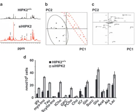 Figure 1 1 H-NMR analyses of different metabolic profiles in HIPK2-proficient (HIPK2 þ / þ ) compared with HIPK2-depleted (siHIPK2) cancer cells