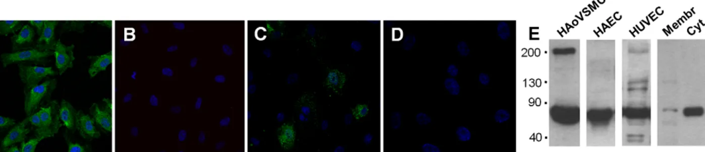 Figure 1. CaSR protein expression in HUVECs by Immunofluorescence Confocal Microscopy and Western Blot