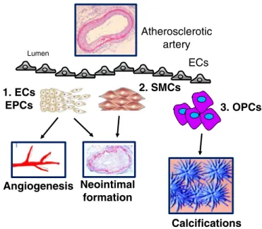 Fig. 1. Cellular mechanisms associated with diabetic macroangiopathy. The ﬁgure de- de-picts the main cellular mechanisms underlying arterial calciﬁcation, neointimal formation and angiogenesis in the atherosclelrotic aorta