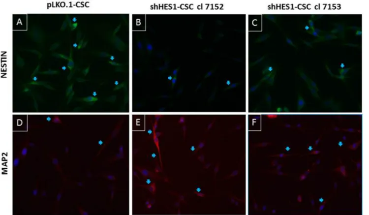 Figure 3: Modulation of neural differentiation in shHes1-CSC by immunofluorescence assay