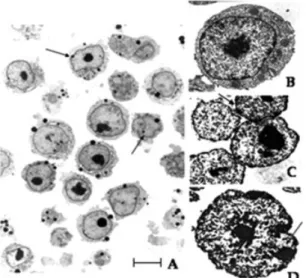 Fig. 1. Morphological features of Raji and K562 cells or nuclei observed at transmission electron microscopy level