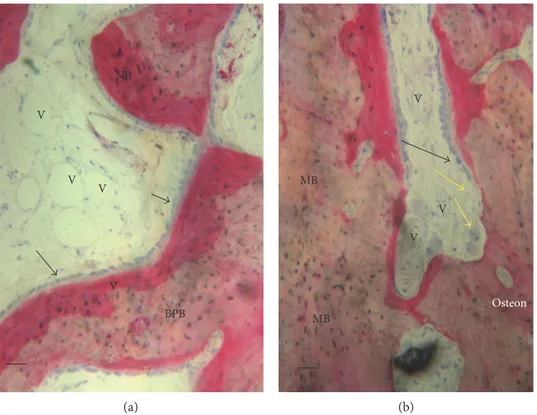Figure 6: (a) BPB group. Bone tissue was deposited in the block material (BPB). No ﬁbrous tissue was observed in the defect area