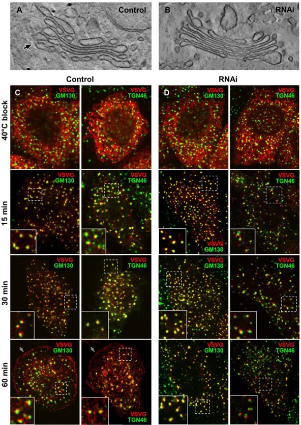 Figure 6. RNAi of cPLA 2 a affects intercisternal connections and transport within NZ-induced Golgi ministacks